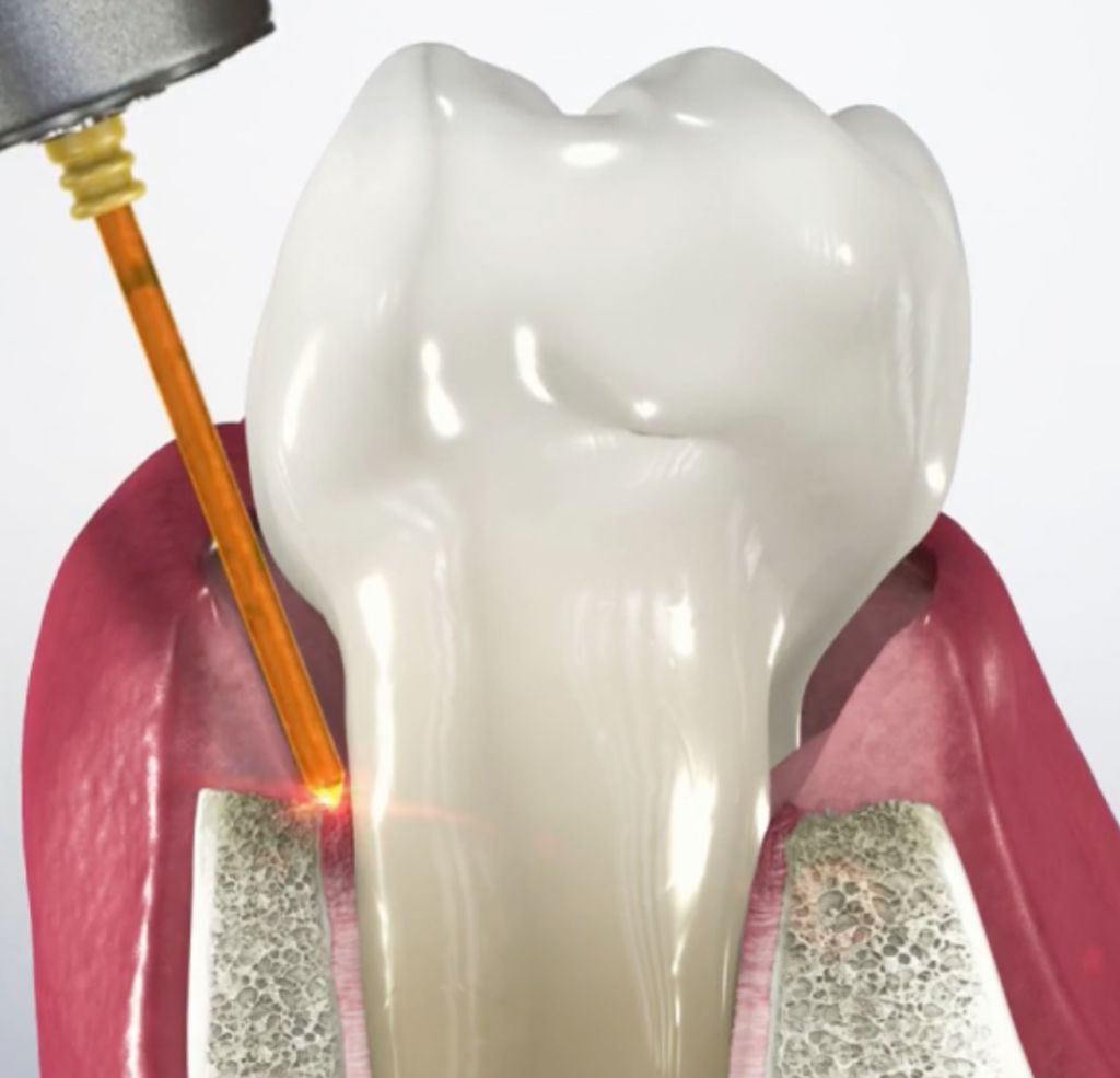 dental cleaning tucson Educational Videos Tucson
