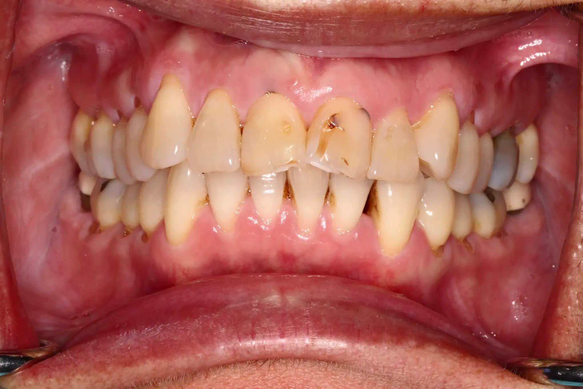 Newman Dental