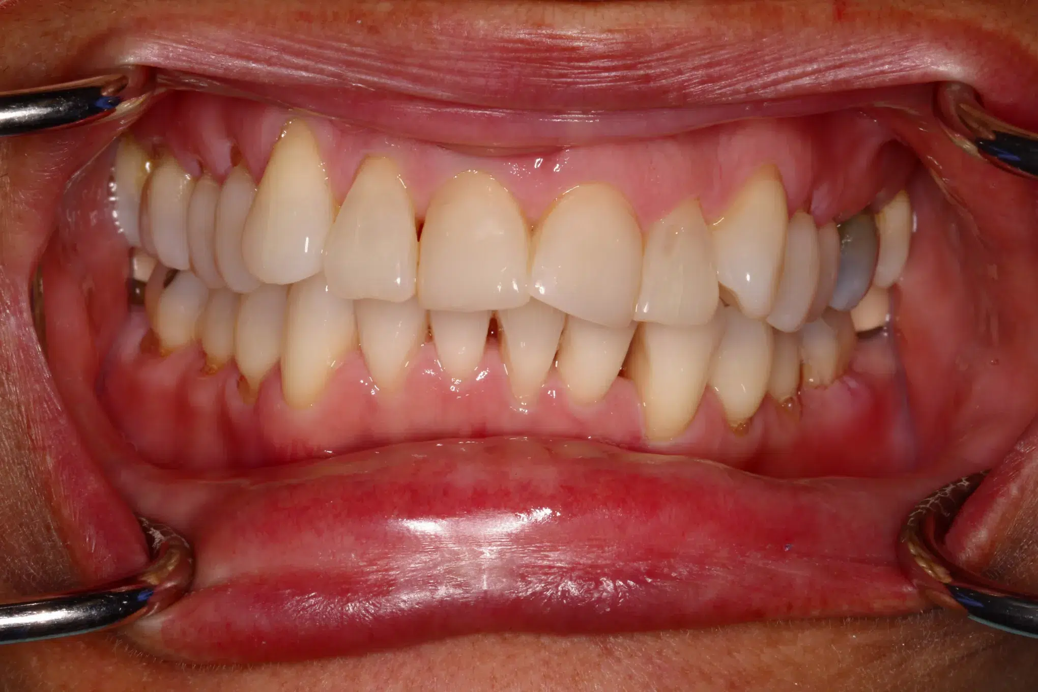 Newman Dental