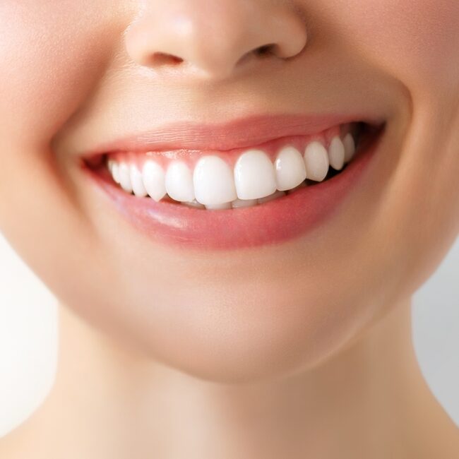 Teeth Whitening Tucson